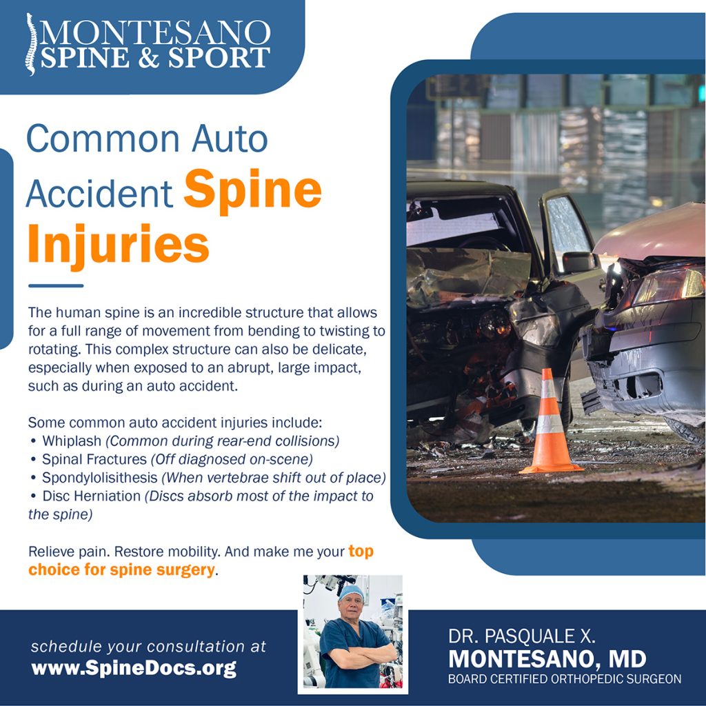 Discover common auto accident spine injuries. Dr. Pasquale X Montesano offers surgical and nonsurgical solutions to fit your needs.