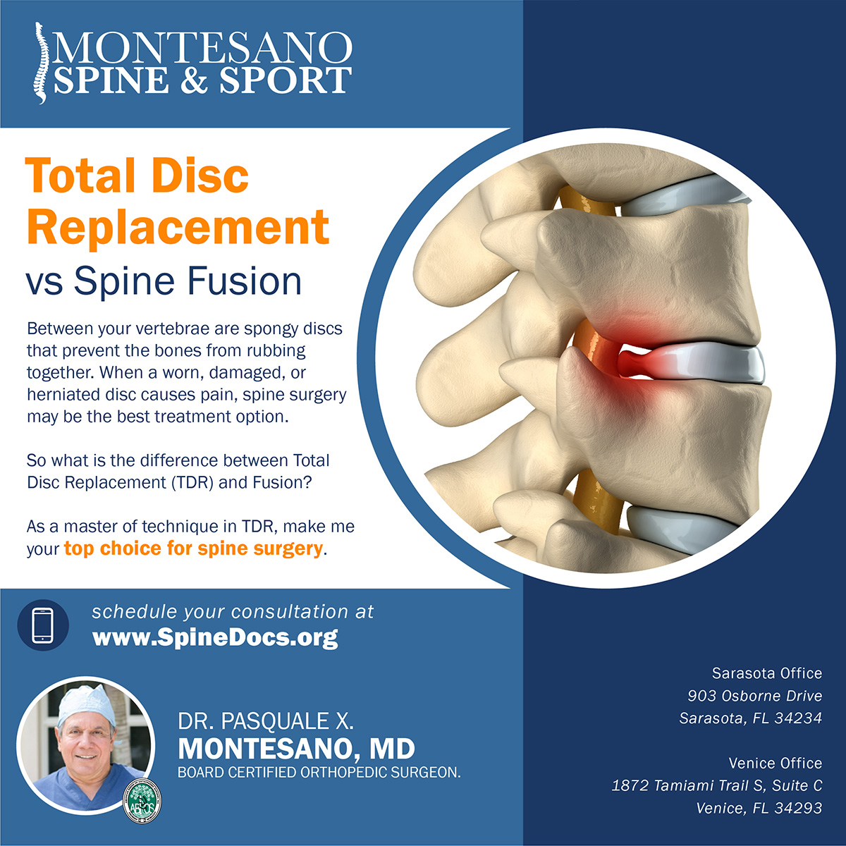 Read more about the article Total Disc Replacement (TDR) vs Spine Fusion